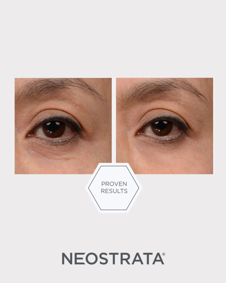 Kuva sosiaaliseen mediaan NEOSTRATA Intensive Eye Therapy 1