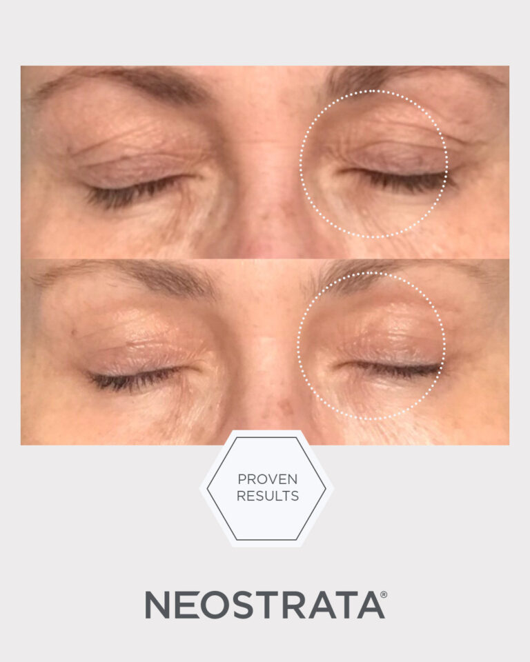 Kuva sosiaaliseen mediaan NEOSTRATA Intensive Eye Therapy 7