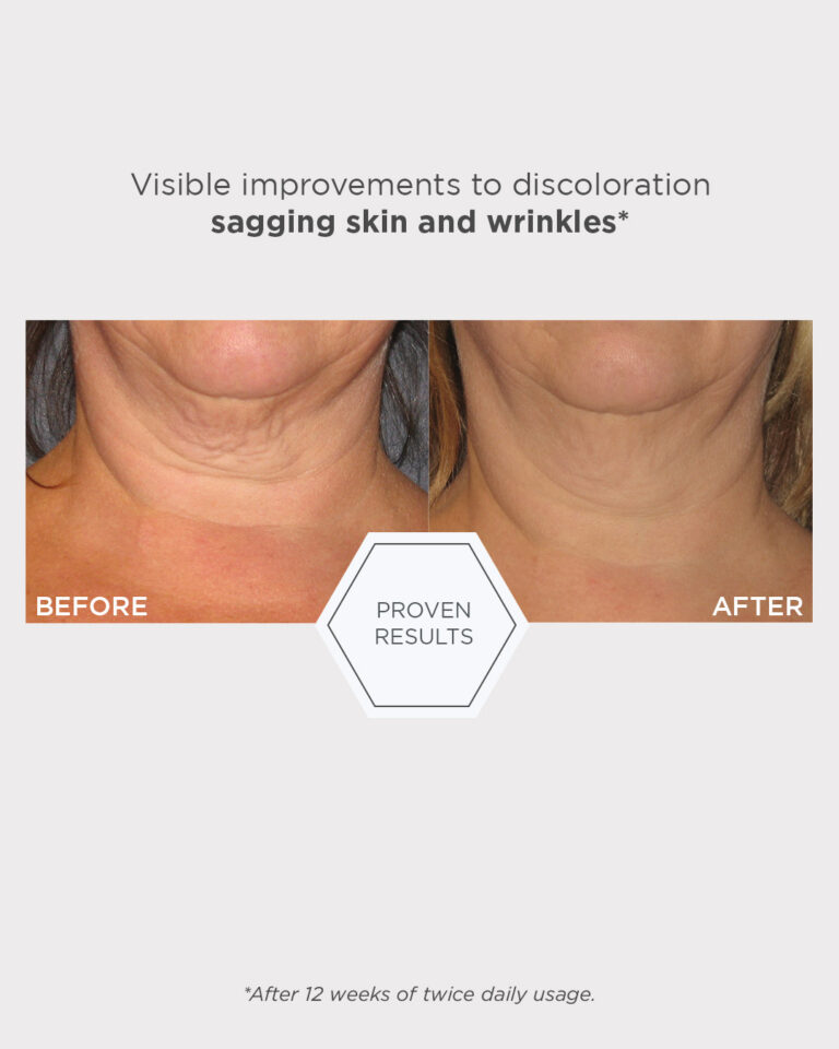 Kuva sosiaaliseen mediaan NEOSTRATA Triple Firming Neck Cream 4