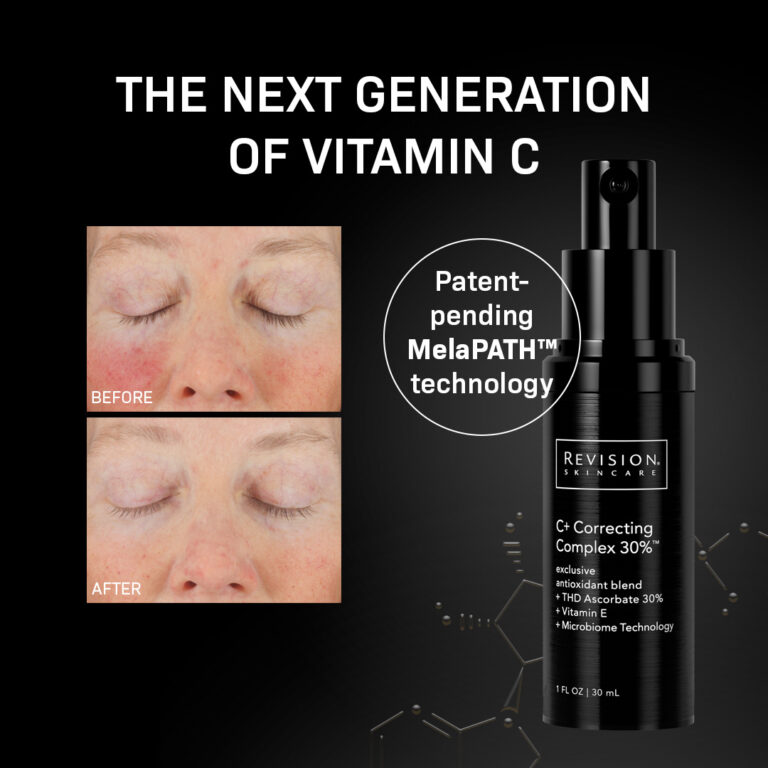 Kuva sosiaaliseen mediaan Revision Skincare 1