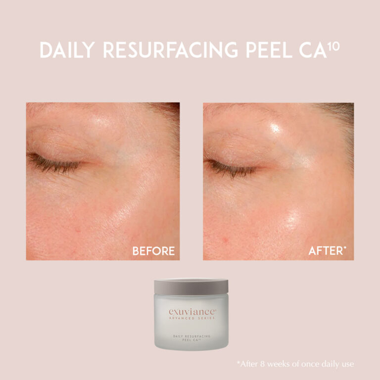 Kuva sosiaaliseen mediaan Exuviance Daily Resurfacing Peel CA10 2