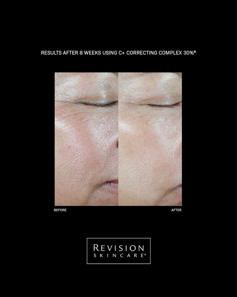 Kuva sosiaaliselle medialle Revision Skincare C Correcting